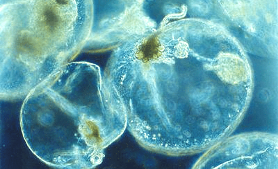 Green Noctiluca S. cells under a microscope. Source: Maria Antónia Sampayo, Instituto de Oceanografia, Faculdade Ciências da Universidade de Lisboa - http://planktonnet.awi.de (provided under a Creative Commons Attribution 3.0 License)